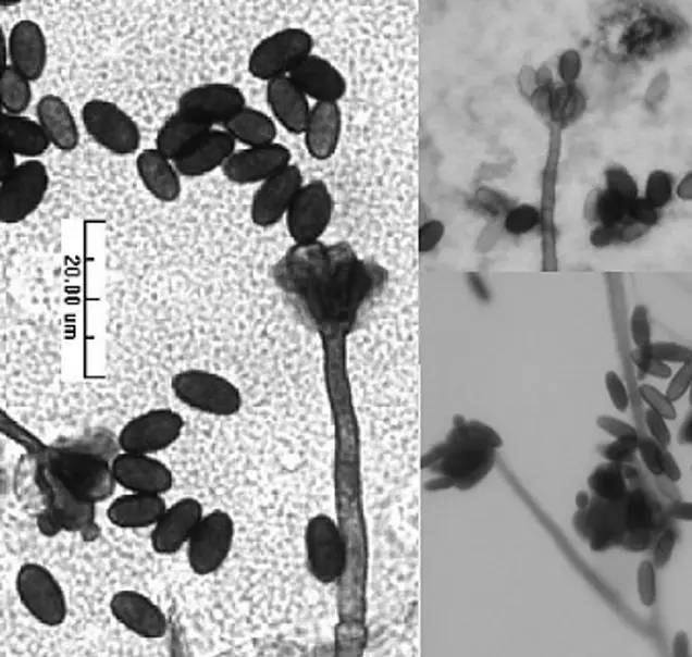 Microscopic image showing clusters of dark, oval-shaped fungal spores on stalks against a light background, ideal for sampling. A scale marker indicating 20.0 µm is present in the left section of the image.