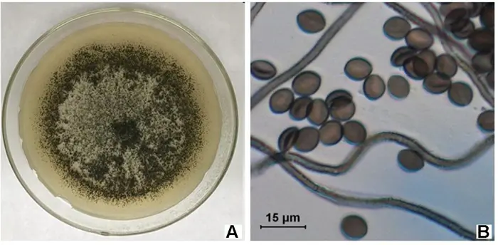 Image A shows a petri dish with a dark fungal colony growing on agar under investigation. Image B is a microscope view of fungal spores, revealing round, brownish spores with surrounding hyphae. A scale bar indicates 15 micrometers, assisting in detailed inspection.