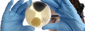 A person wearing blue gloves and protective eyewear holds up a petri dish, meticulously investigating the growth of microorganisms, possibly mold, inside it. The white background enhances the focus on this scientific assessment.
