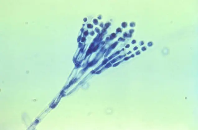 A microscopic view of Aspergillus spores reveals a mold's blue-stained conidiophore with spherical conidia radiating from its top, set against a light green background. This intricate sampling provides crucial insight for assessment purposes.