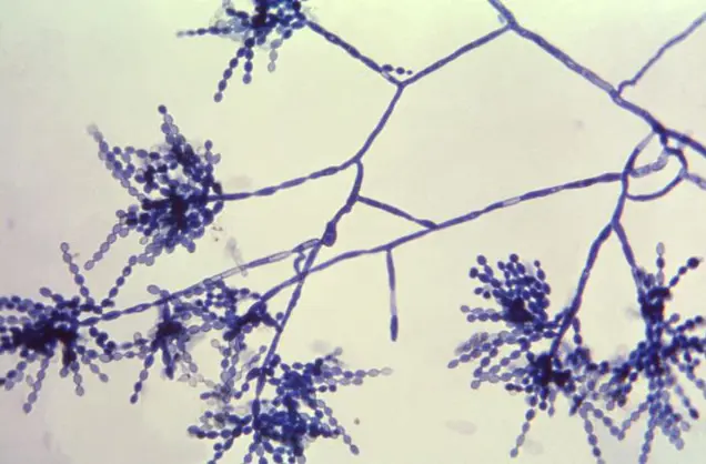 Microscopic inspection of Penicillium mold reveals branching structures and spore chains, stained in dark blue against a light background.